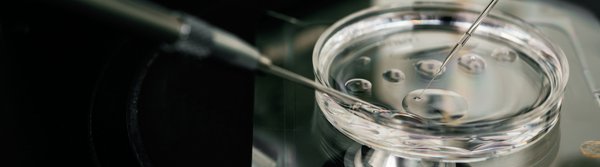 ЕКЗ: що таке екстракорпоральне запліднення