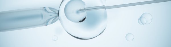 Історія ІРМ